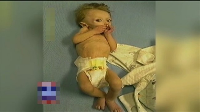 Užas: Roditelji izgladnjivali bebu do smrti jer su bili lijeni da je hrane