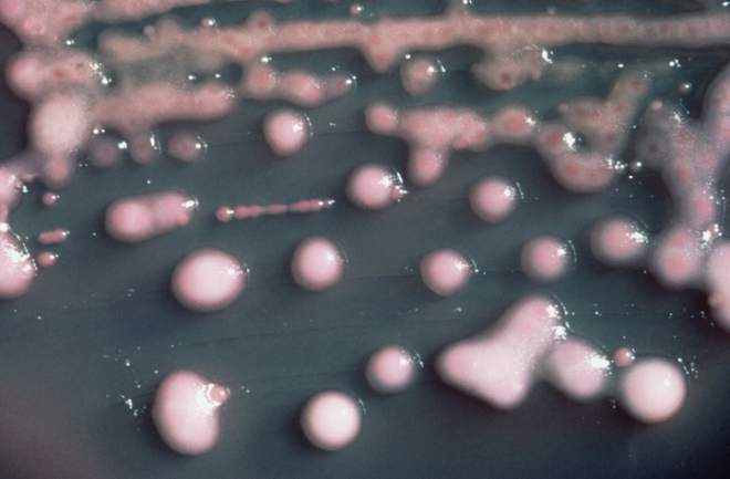 Srbija rasadnik smrtonosne superbakterije, otporne i na najjače antibiotike