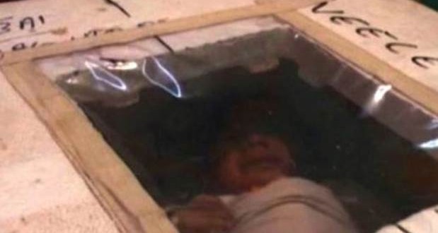 Dijete morali držati pet mjeseci u kutiji od stiropora da bi mu spasili život
